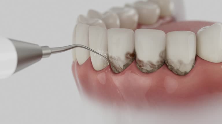 Reliable Emergency Dentist contractor in Welsh, LA by Smile Center Dentistry